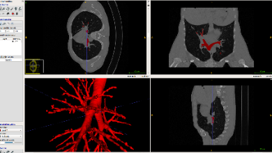健培AI團隊在全球EXACT’09賽事中取得優(yōu)異成績